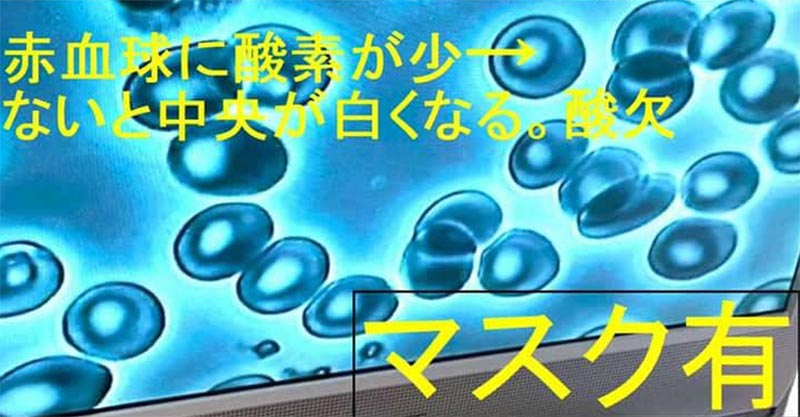 マスクによって酸欠状態になった赤血球