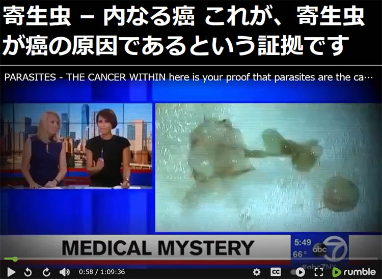 寄生虫ががんを引き起こしている